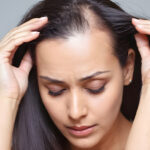 hair loss treatment near me