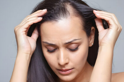 hair loss treatment near me