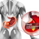 Common Parasitic Infections Treated with Fenbendazole Tablet