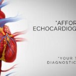 Echocardiography Test in Bangalore