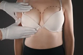 How to Prepare for Surgery with the Best Breast Enhancement Surgeons in Dubai