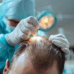 Hair transplant in islamabad